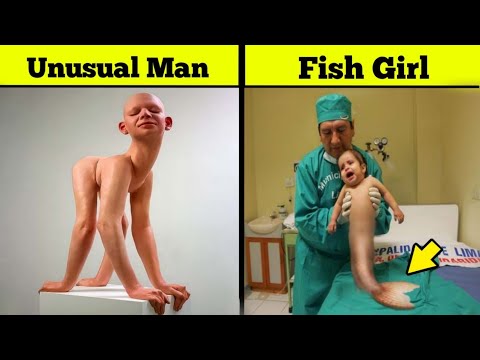 Most Unusual People Ever Born On Earth | Haider Tv - YouTube